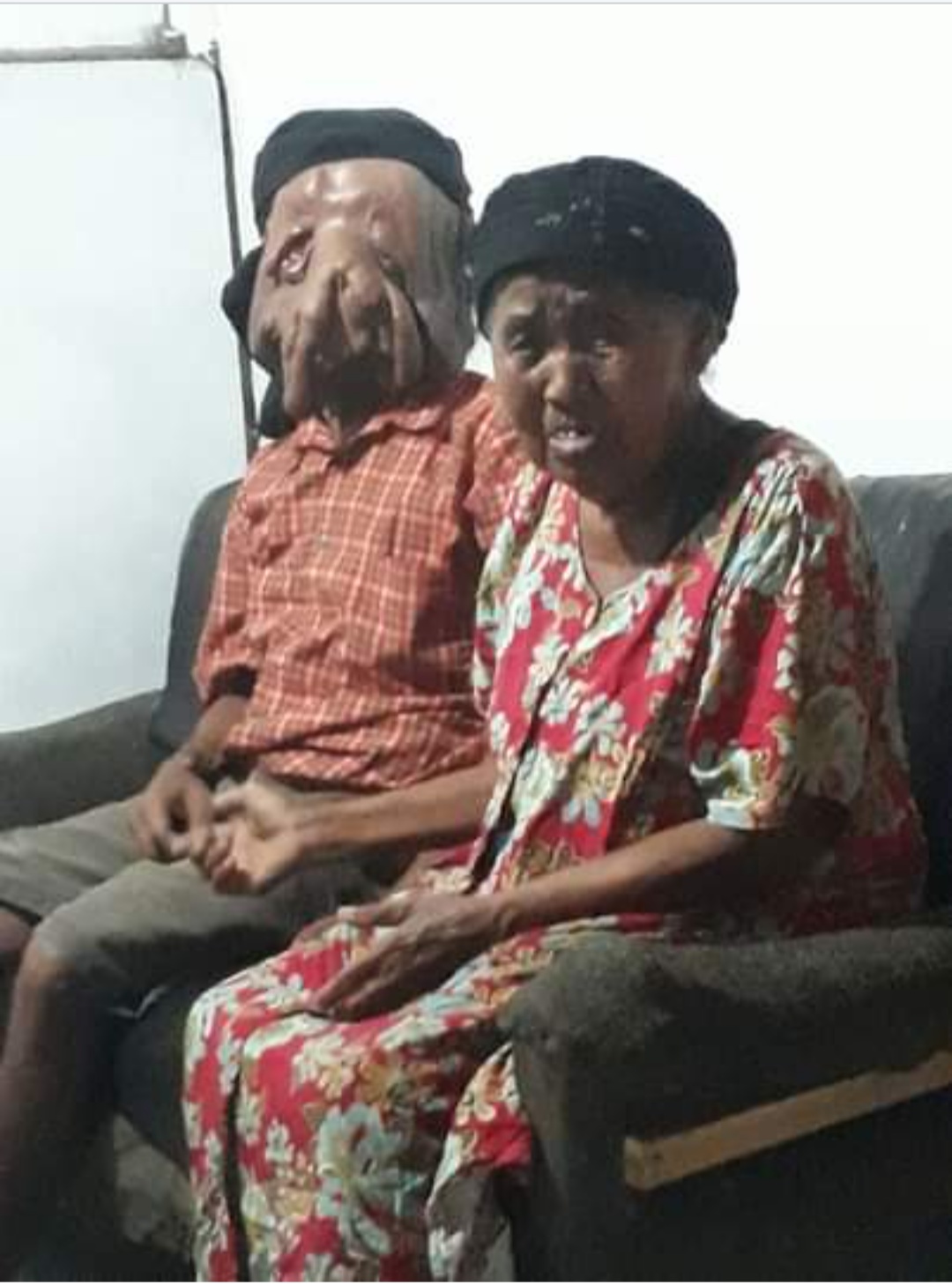 Purwanto penderita tumor di wajah bersama ibunya 
